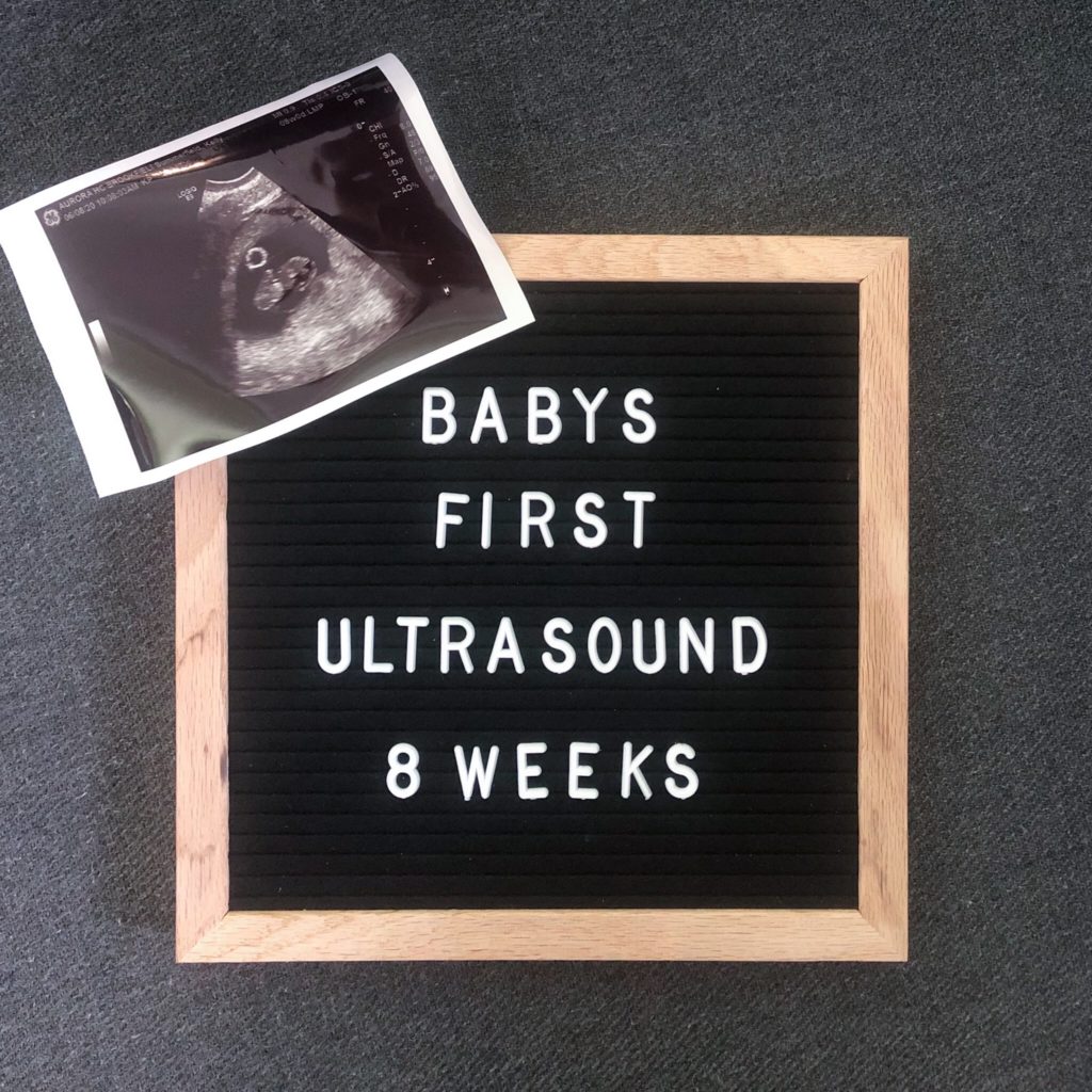 First Trimester Ultrasound 8 Weeks